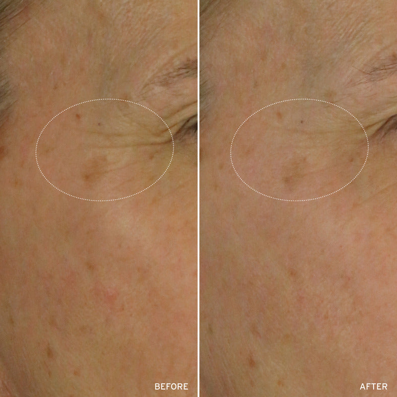 NAD+ CELL ENERGIZING TREATMENT