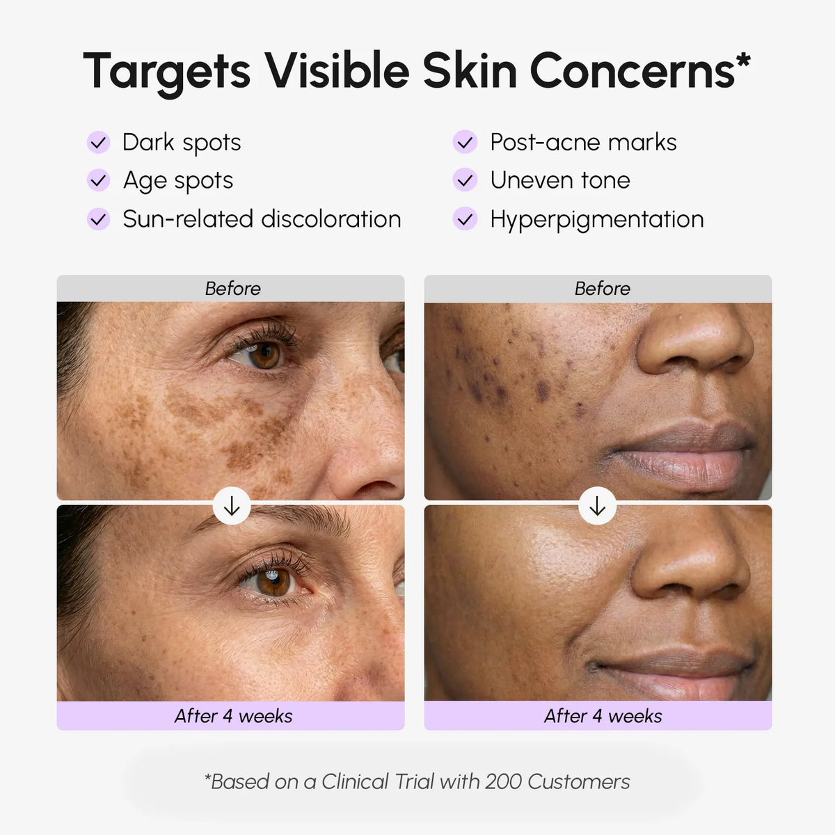 Maree - Face & Body Serum for Dark Spots