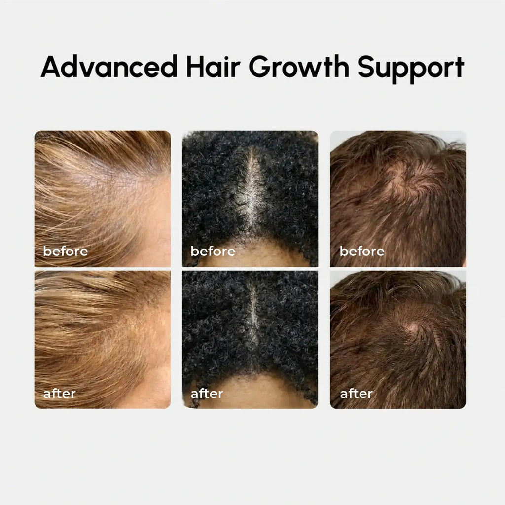 Maree - 4-in-1 Hair Growth Spray