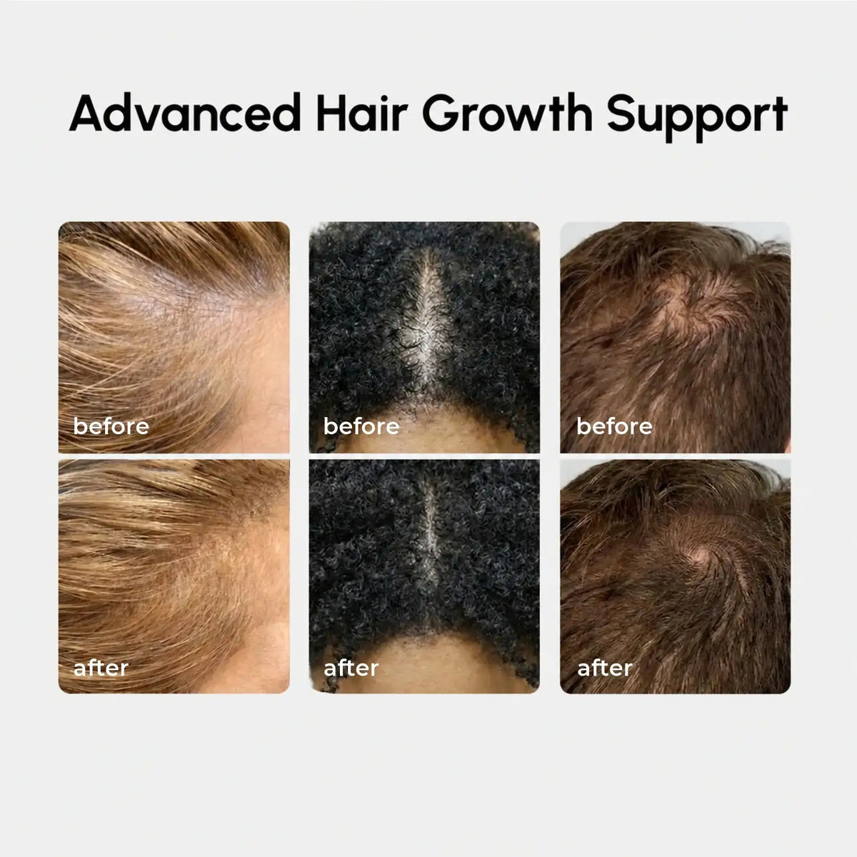 Maree - 4-in-1 Hair Growth Spray