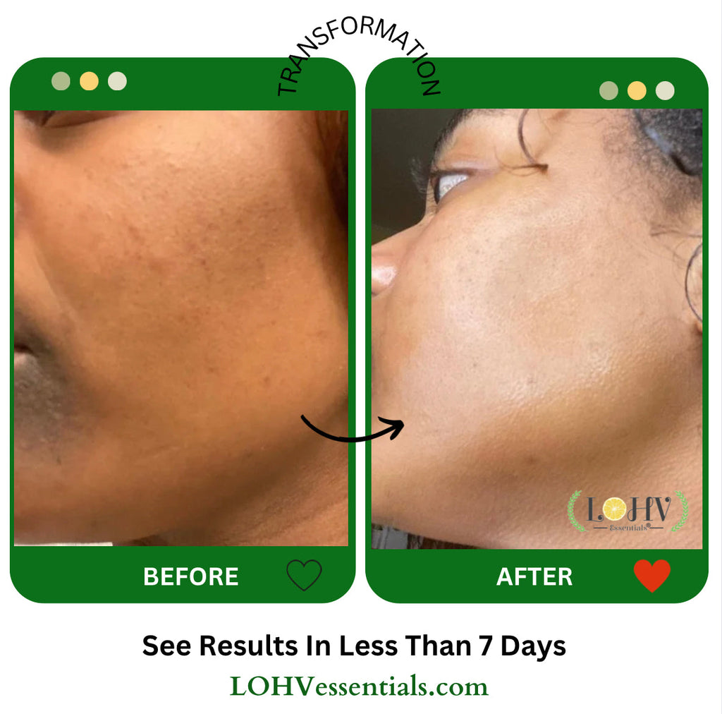LOHV ESSENTIALS - PREMIUM 100% VEGAN GLOW UP Toner Serum With Hyaluronic Acid + Niacinamide + Camellia Leaf + Vitamin E + Rose Water