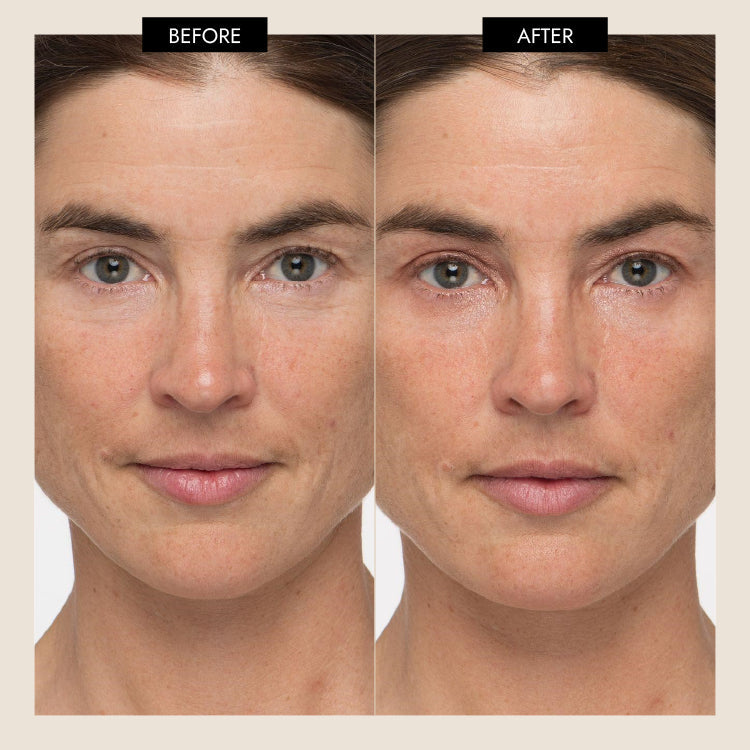 7E Wellness - MyoLift Triwave Microcurrent Device