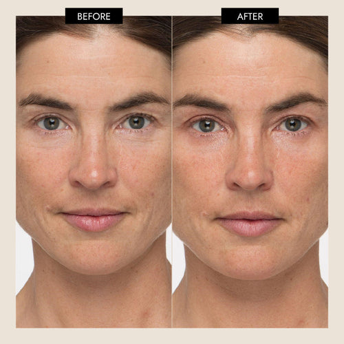 7E Wellness - MyoLift Triwave Microcurrent Device