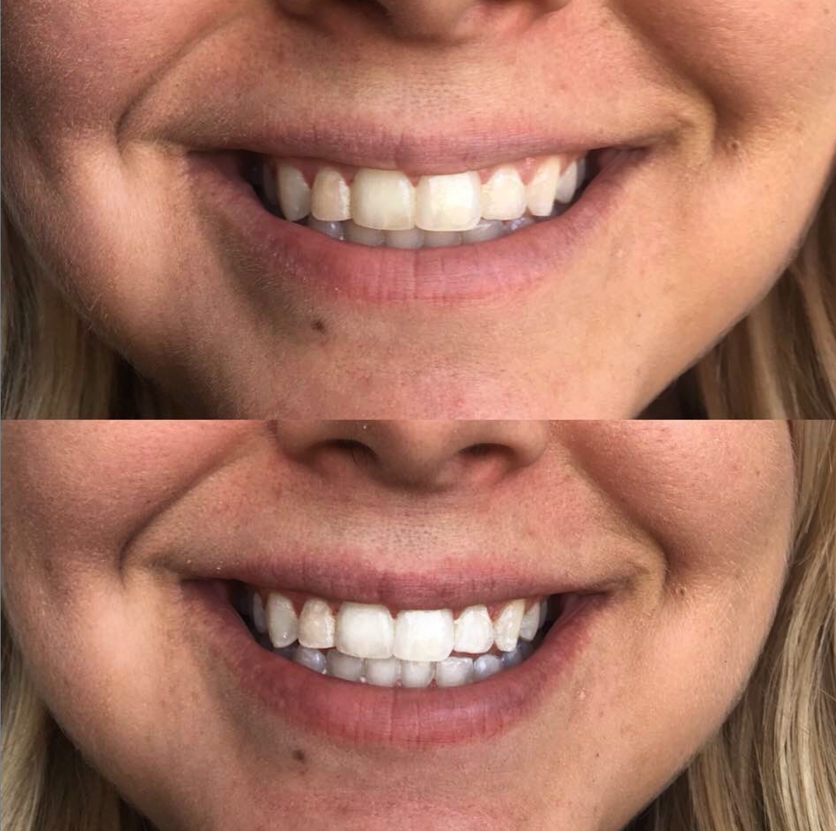 Beaut.BeautyCo - cozy smile kit