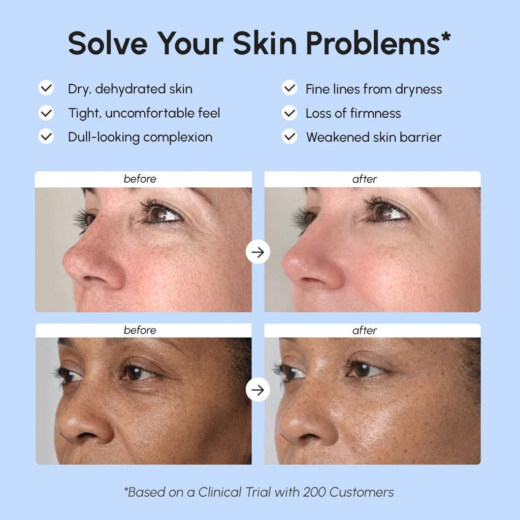 Maree - Firming & Lifting Collagen Moisturizer